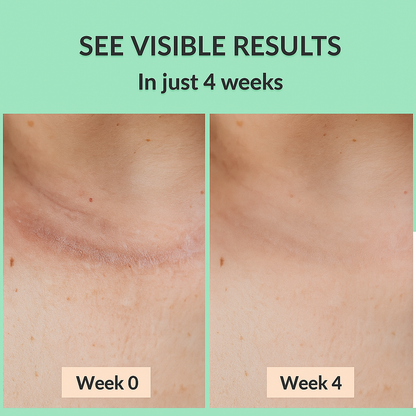 Dermera™ - Silicone Scar Sheets