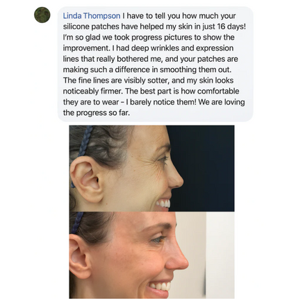 Dermera™ - Silicone Scar Sheets